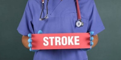 Jangan abaikan Gejala Stroke, Termasuk Cegukan! 