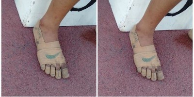 Menggunakan Perban Pengganti Sepatu, Gadis Ini Berhasil Sabet Tiga Emas.