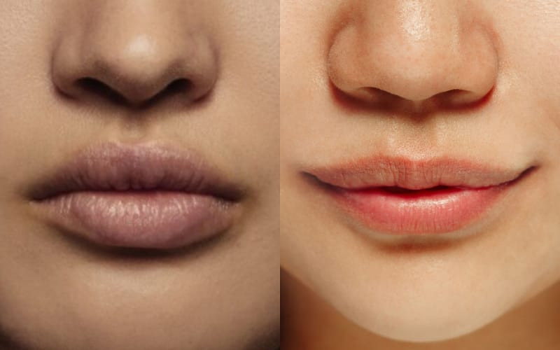 Ilustrasi dua warna bibir yang berbeda/Freepik
