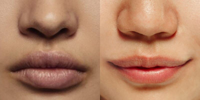 4 Bahan Alami untuk Mencerahkan Warna Bibir yang Gelap