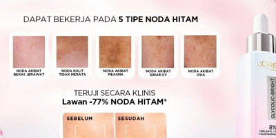 Usung Tagline <i>Beauty That Moves,</i> L'Oréal Hadirkan Serum Pencerah dengan Melasyl untuk Lawan Noda Hitam